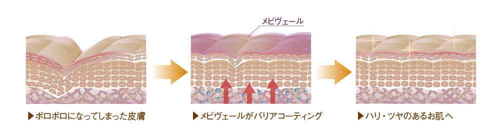 ボロボロに成ってしまった皮膚。メビヴェールがバリアコーティング。ハリ・ツヤのあるお肌。